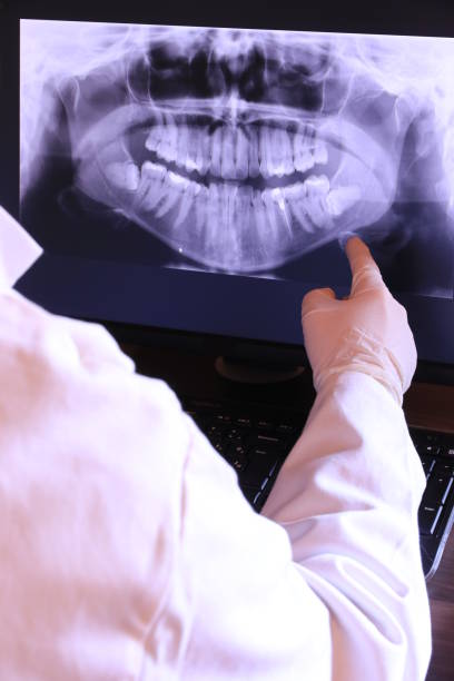 Best Urgent Care for Lost Fillings or Crowns in Burr Ridge, IL