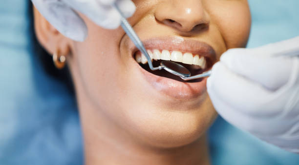 Best Cosmetic Emergency Dentistry in Burr Ridge, IL